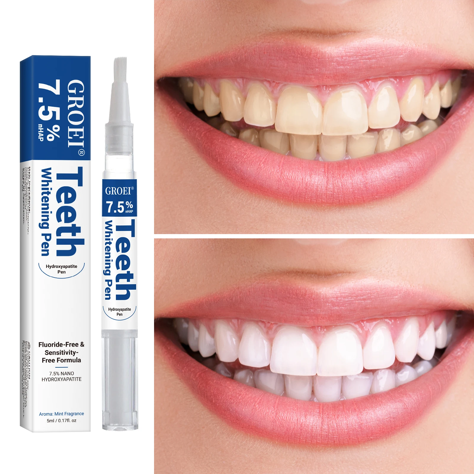 Hydroxyapatite Tooth Whitening - Teeth Whitening Hydrogen Peroxide 评论和价格