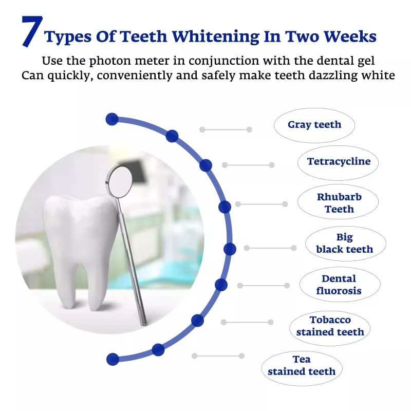 Intelligent LED Blue Light Por - Teeth Whitening With Trays 评论和价格