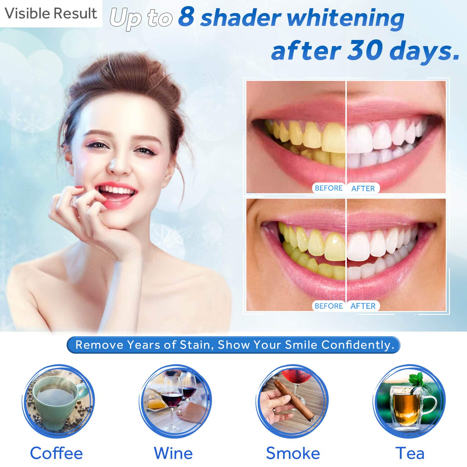 Teeth Whitening Gel Refill Syr - Teeth Whitening With Trays 评论和价格
