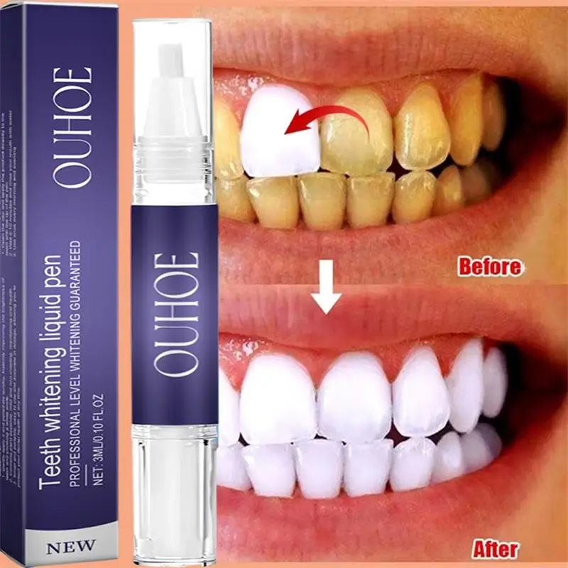 Fast Teeth Whtening Toothpaste - Whitening Pen Bleach 评论和价格
