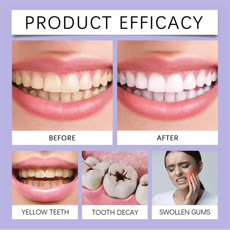 Fast Teeth Whtening Toothpaste - Whitening Pen Bleach 评论和价格